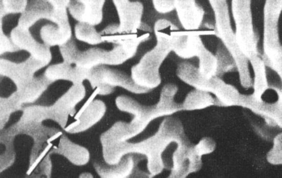 Picture of SEM Aluminum Tungsten Dendrites Test