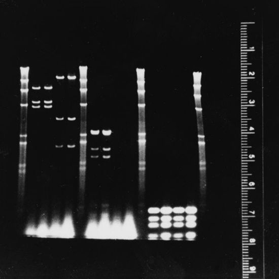 Picture of Fluorescent Ruler Kit