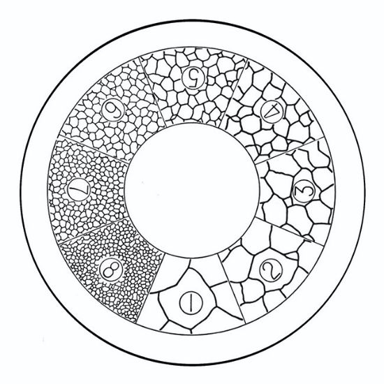 Picture of G41 Astm Austenite Graticule, 19mm