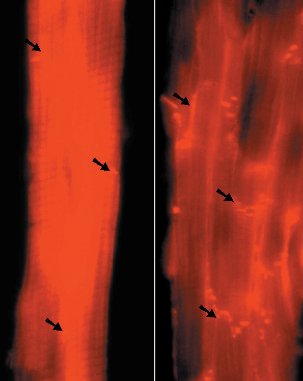 Aurion_Blocking_Micrograph_1