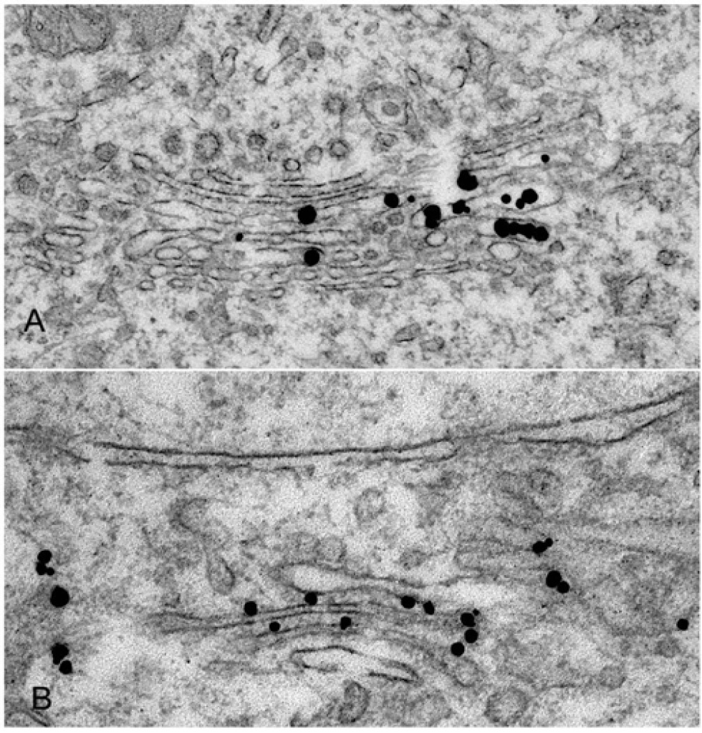 Aurion_Optional_Micrograph_1