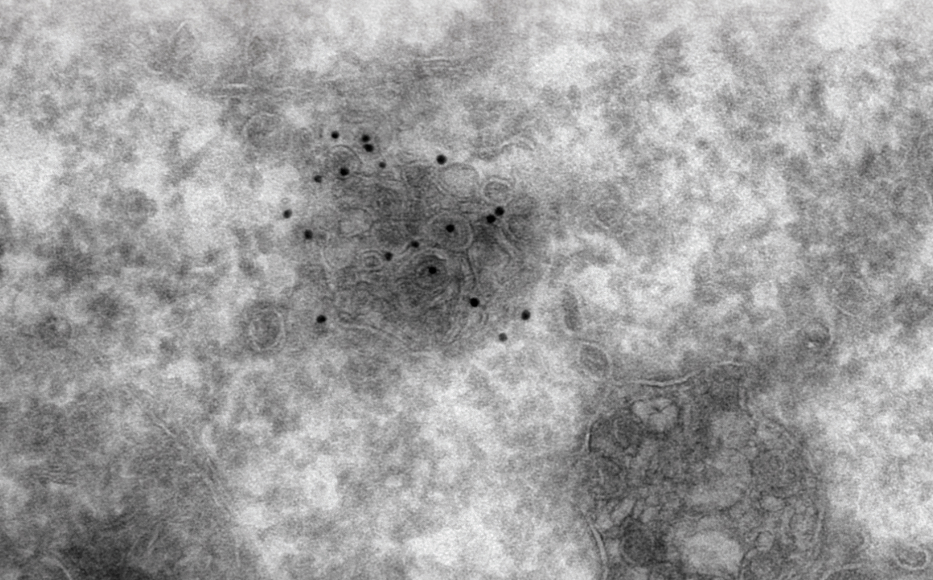 Aurion_Silver_Micrograph_2.jpg